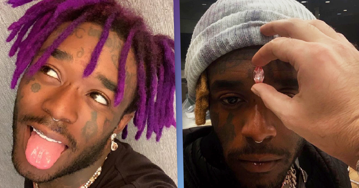 Rapper Lil Uzi Vert pays for $24 million pink diamond forehead implant - Ryan Babel